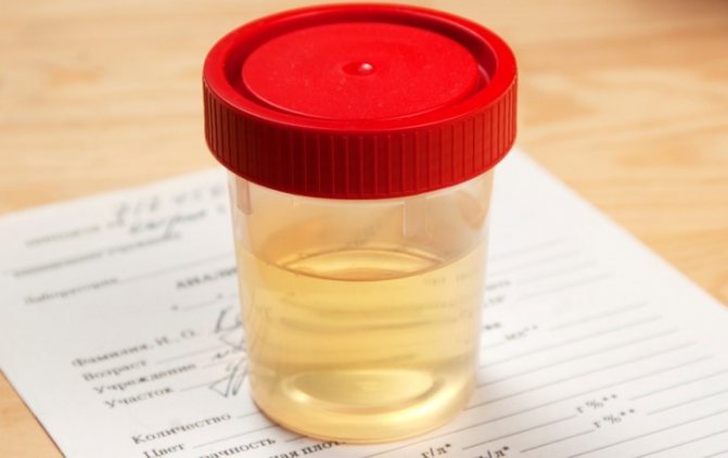 Colorless urine in a 3 year old child
