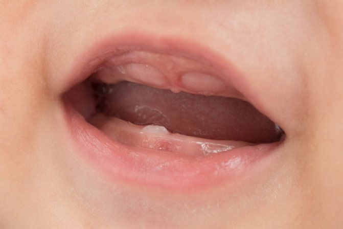 Десна при прорезывании зубов у грудничков