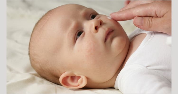 Are ointments effective for diathesis in an infant?