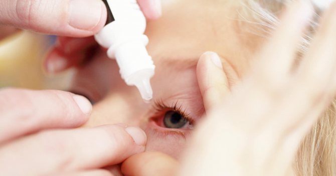 Giving eye drops to a child