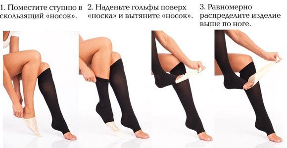Compression stockings for pregnant women