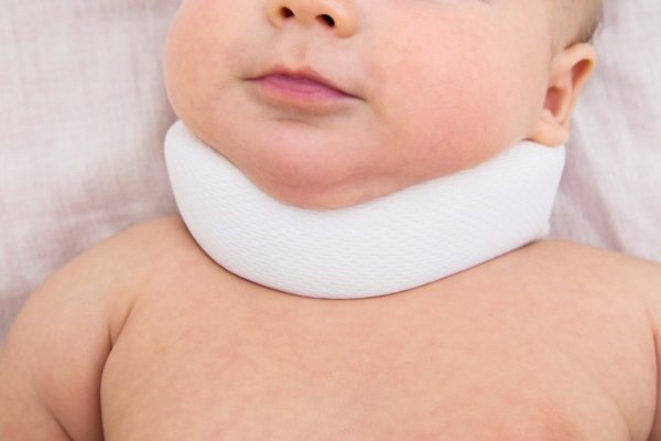 Torticollis in newborns. Causes, signs, photos and treatment 