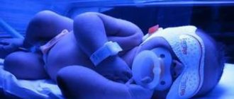 лечение желтушки у новорожденных