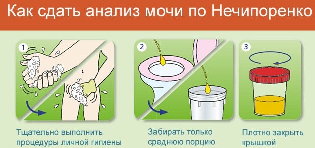 Leukocytes in the child’s urine are increased or decreased. Causes for infants, normal for girls and boys. What to do 