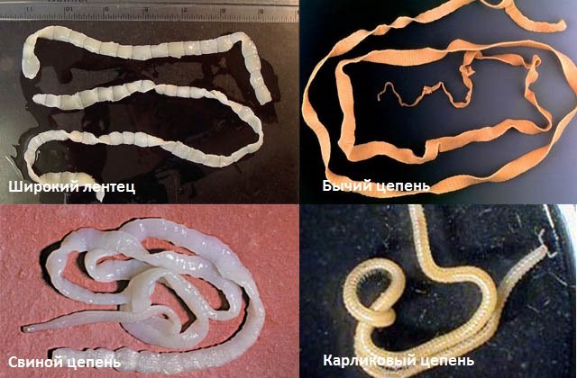 Tapeworms (cestodes)