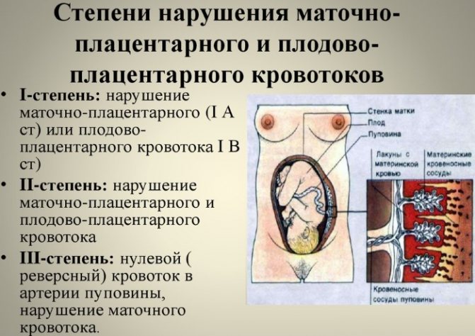 Нарушение гемодинамики 1-3 степени при беременности маточно-плацентарной. Причины, признаки, лечение