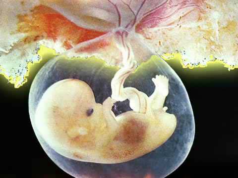 Fetus at 9 weeks of gestation and its development