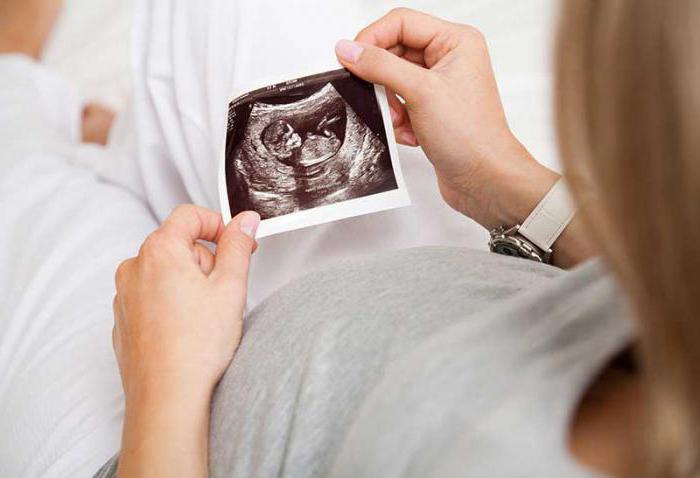 пол ребенка по сердцебиению в 12 недель беременности