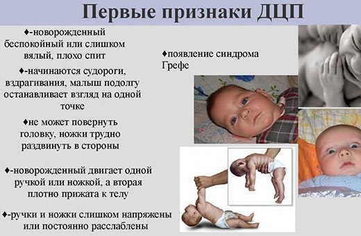 Последствия гипоксии у новорожденного при родах, нарушения психического развития. Лечение