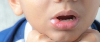 Ребенок с распухшей губой