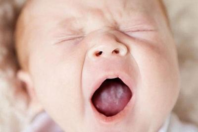 Symptoms of thrush in a newborn