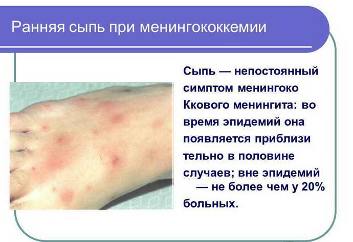 meningitis rash pathogens