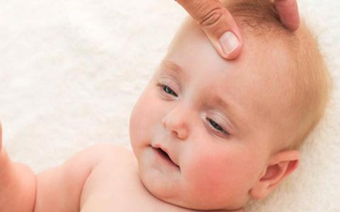 sunken fontanel in an infant
